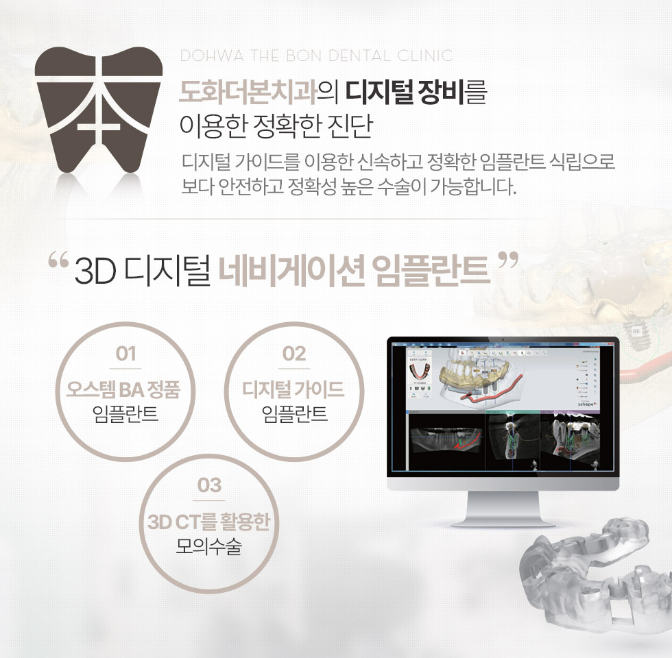 도화더본치과의 디지털 장비를 이용한 정확한 진단 3D 디지털 네비게이션 임플란트