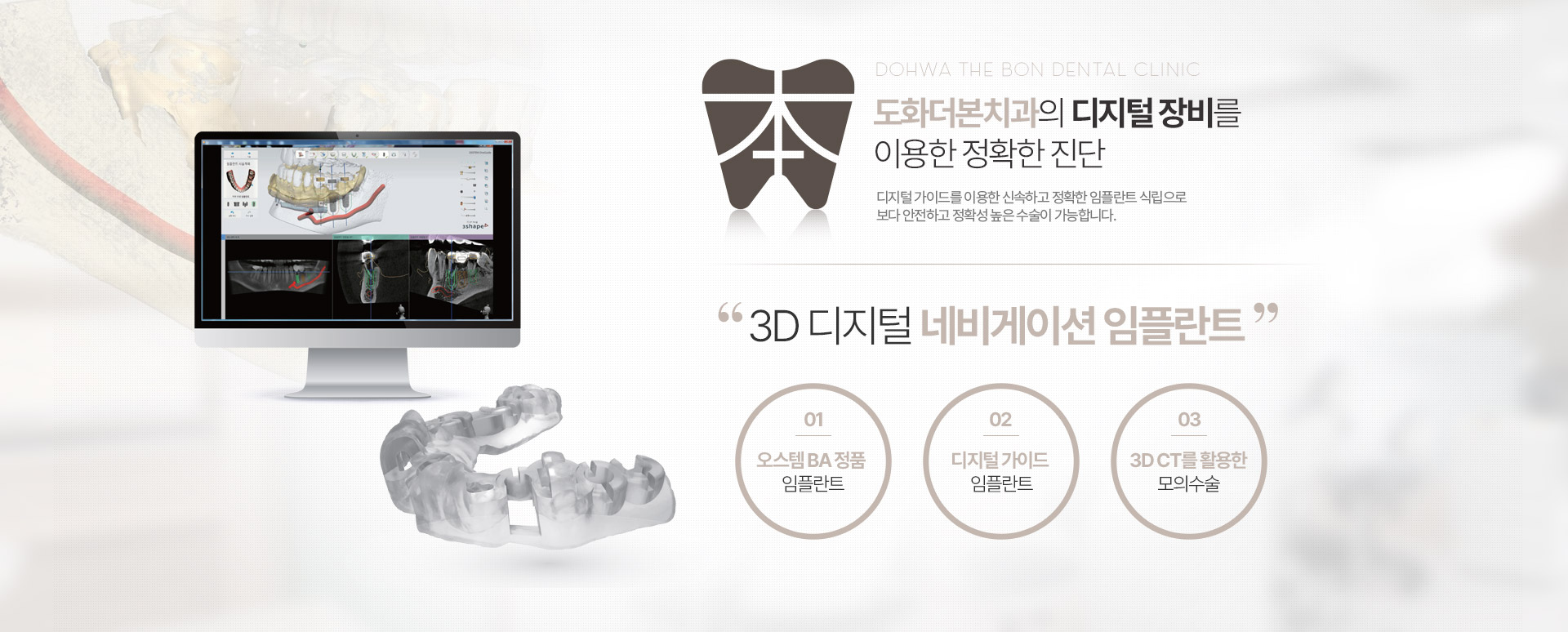 도화더본치과의 디지털 장비를 이용한 정확한 진단 3D 디지털 네비게이션 임플란트